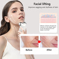 Face Lifting Massager - Mirelle