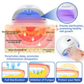 Fungus Laser Therapy Device - Mirelle