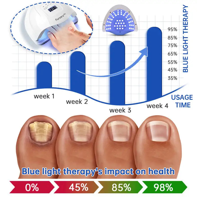 Fungus Laser Therapy Device - Mirelle